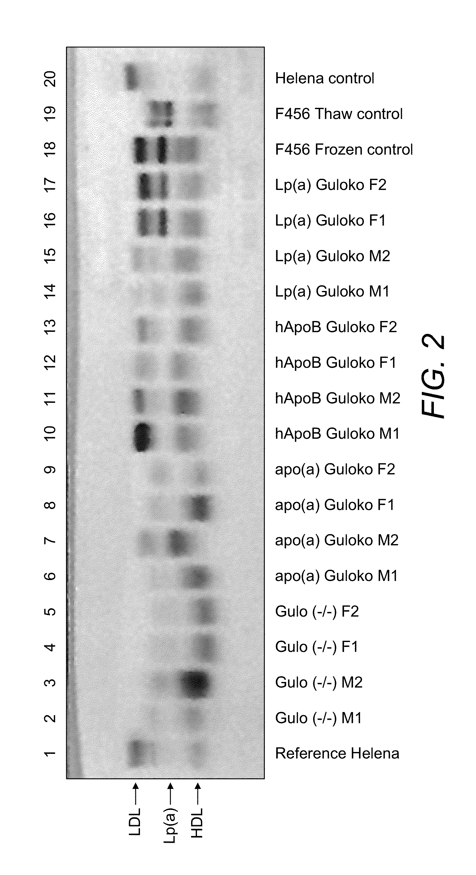 Transgenic mouse expressing human apo(a) and human apo(B-100) with disabled vitamin C gene produces human Lp(a)