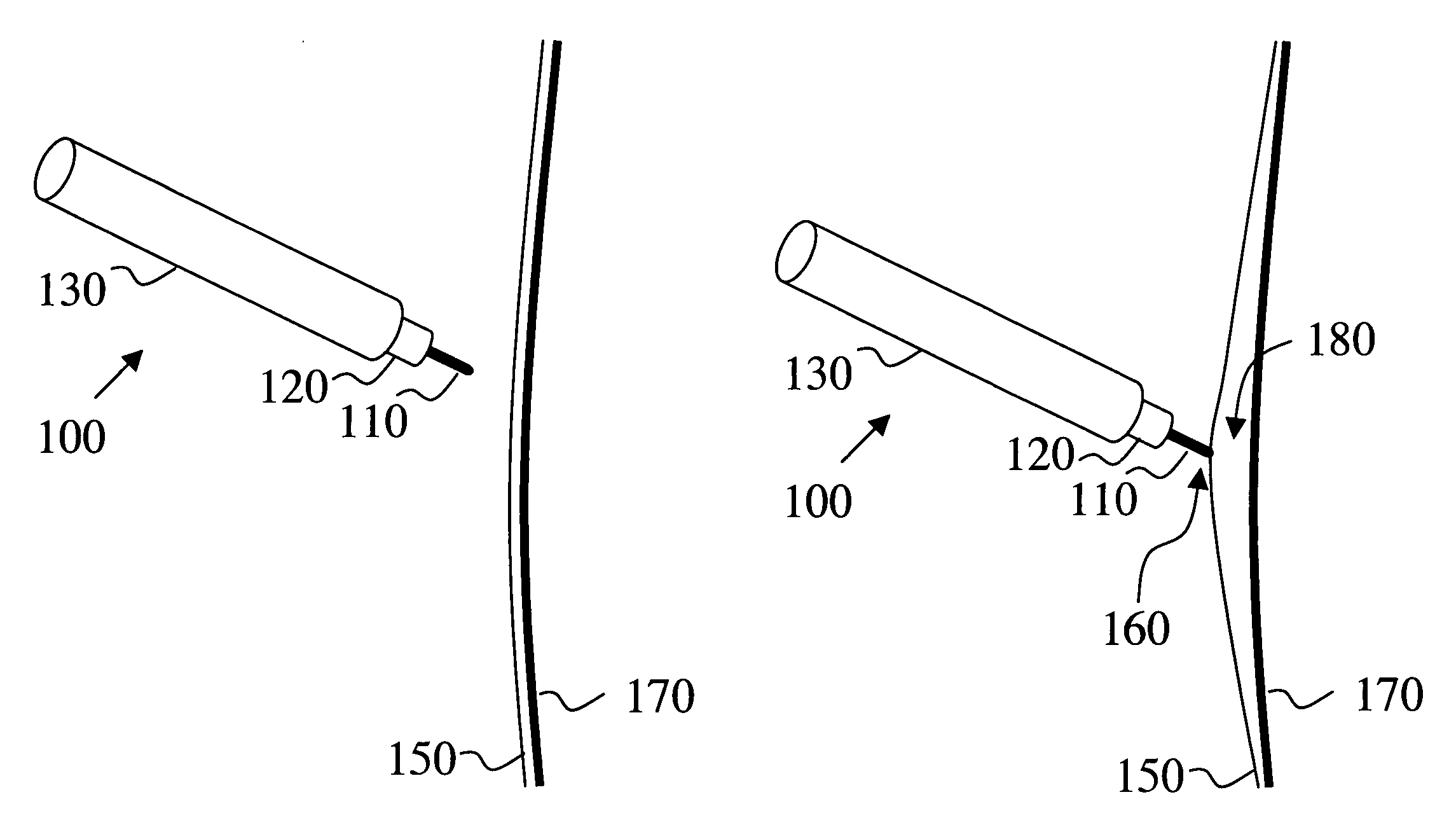 Electro-adhesive tissue manipulator