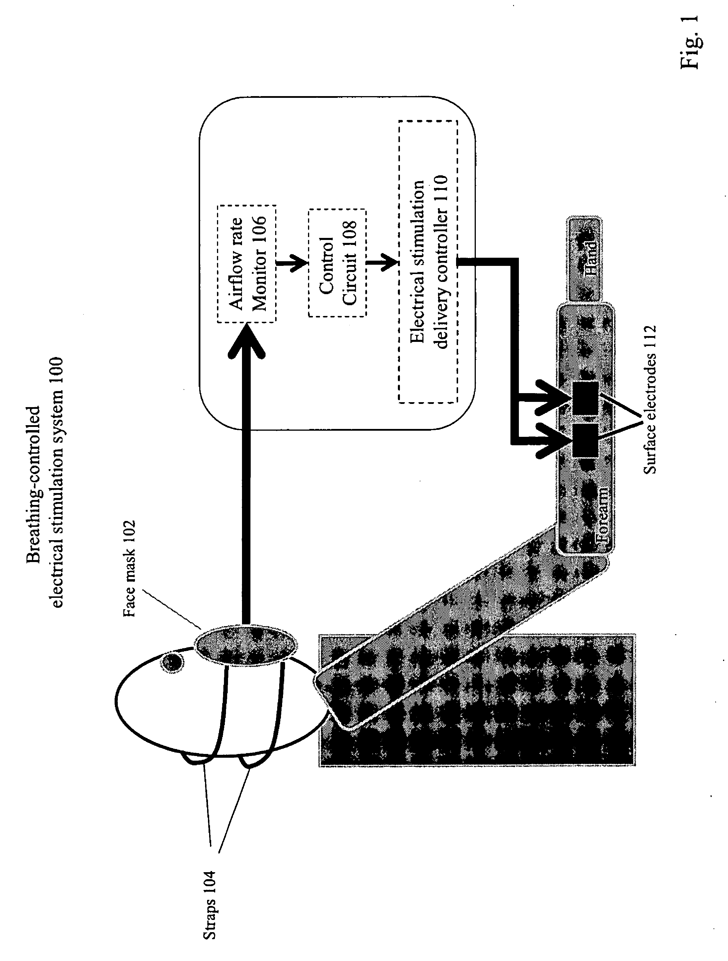 Method and apparatus of breathing-controlled electrical stimulation for skeletal muscles