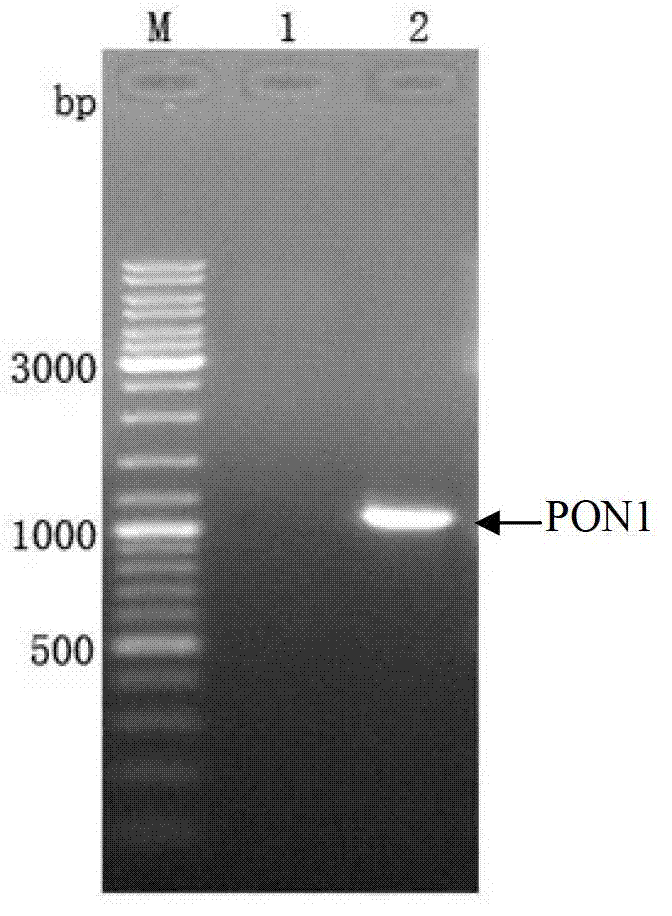 Silkworm recombination baculovirus expressing paraoxonase 1 gene and preparation method and application thereof