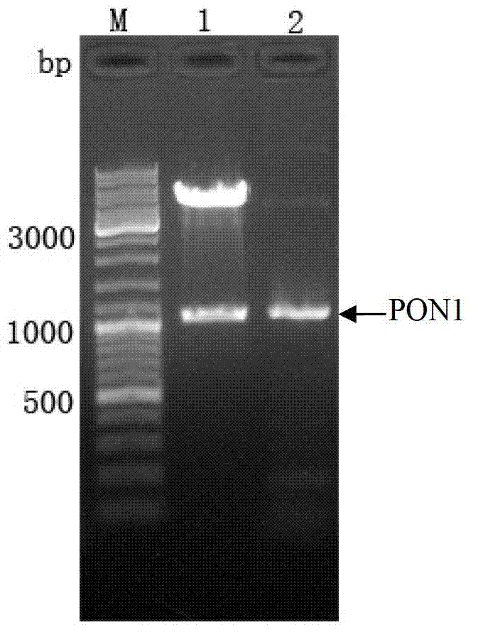 Silkworm recombination baculovirus expressing paraoxonase 1 gene and preparation method and application thereof