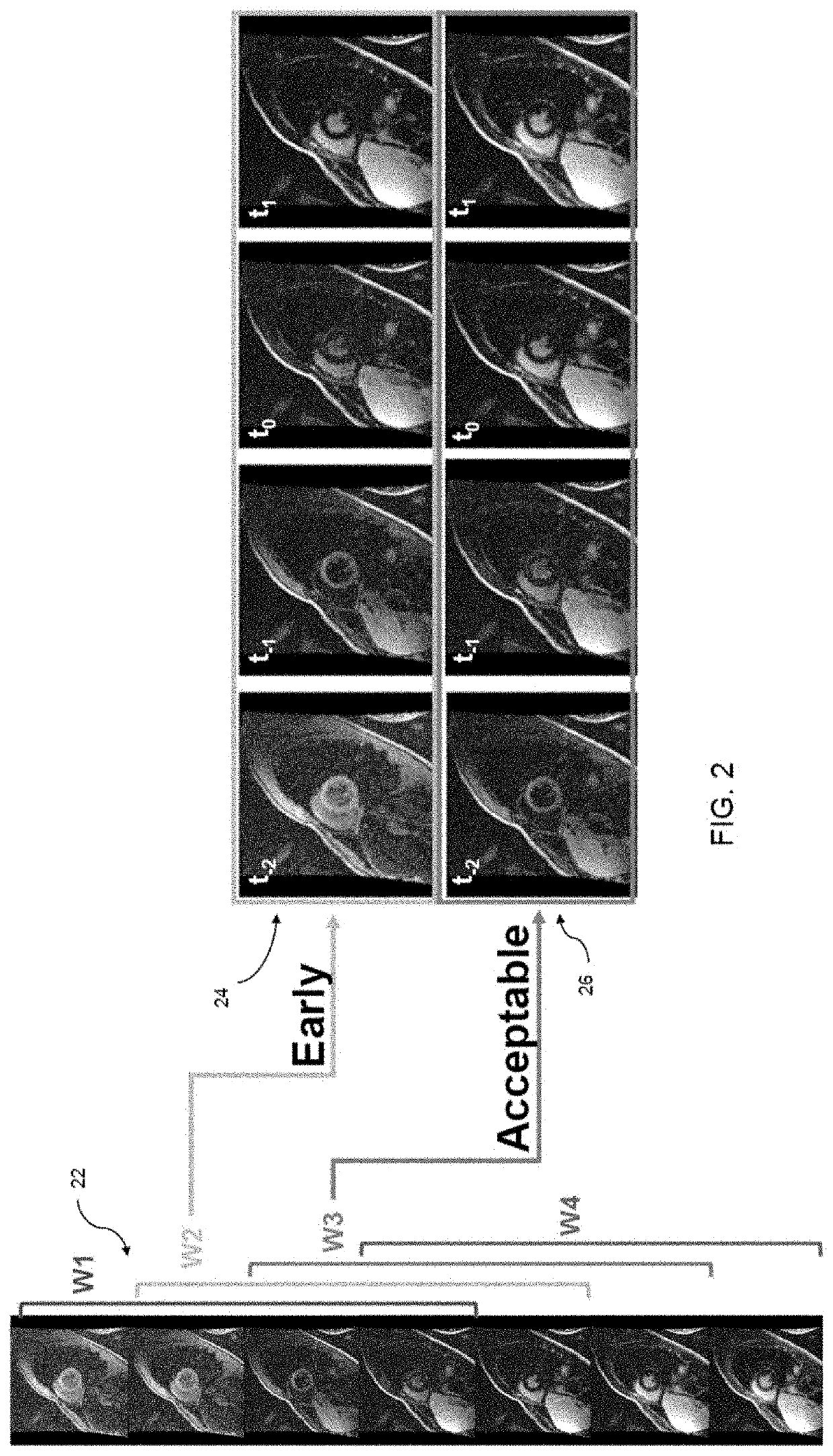 Automated selection of an optimal image from a series of images