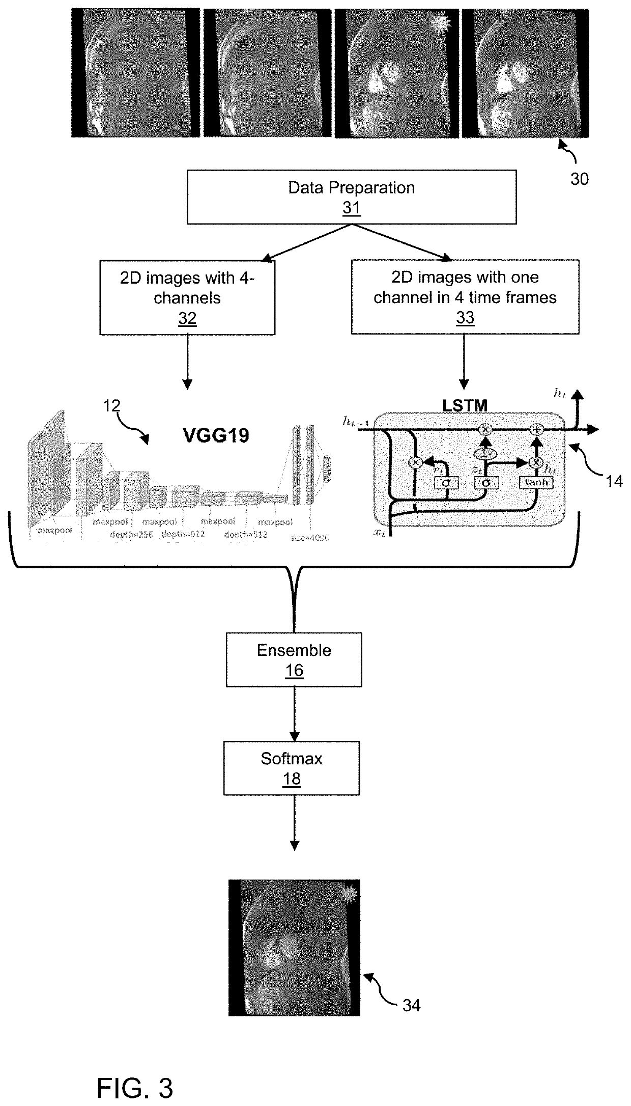 Automated selection of an optimal image from a series of images