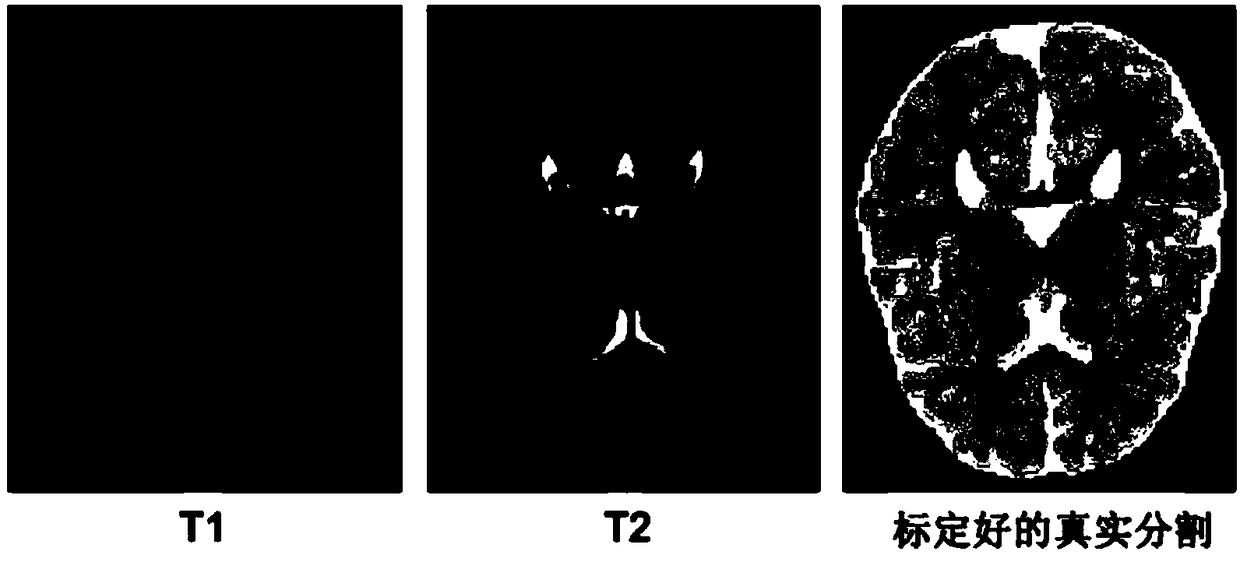 Infant brain magnetic resonance image partitioning method based on fully convolutional network