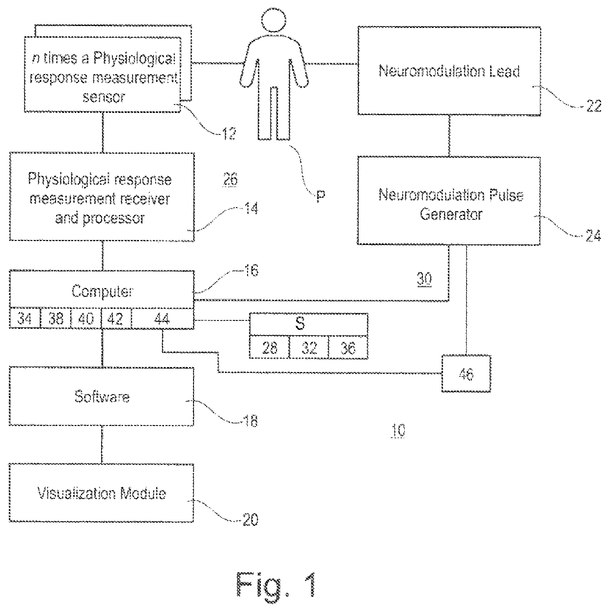 System for planning and/or providing neuromodulation, especially neurostimulation