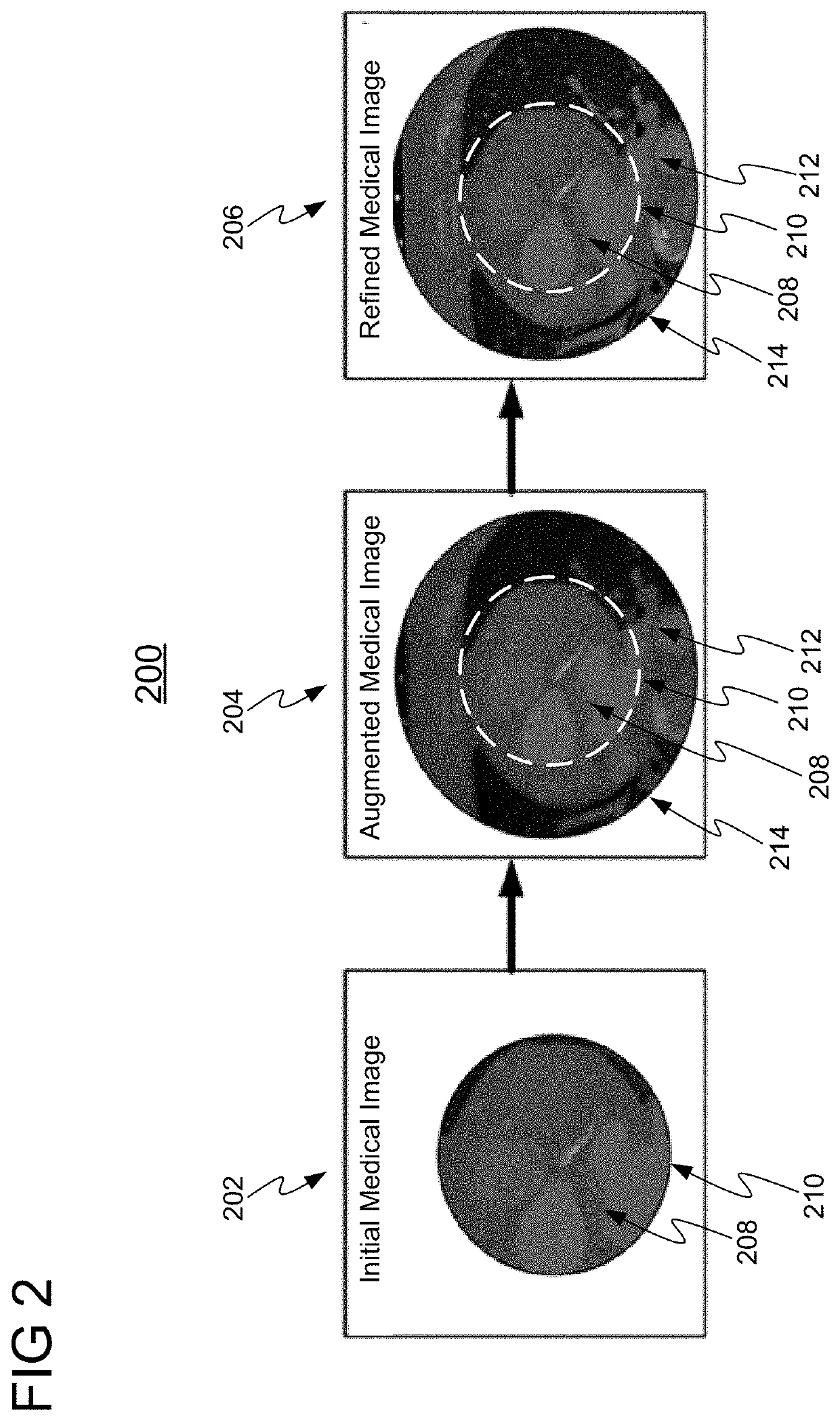 Medical image enhancement