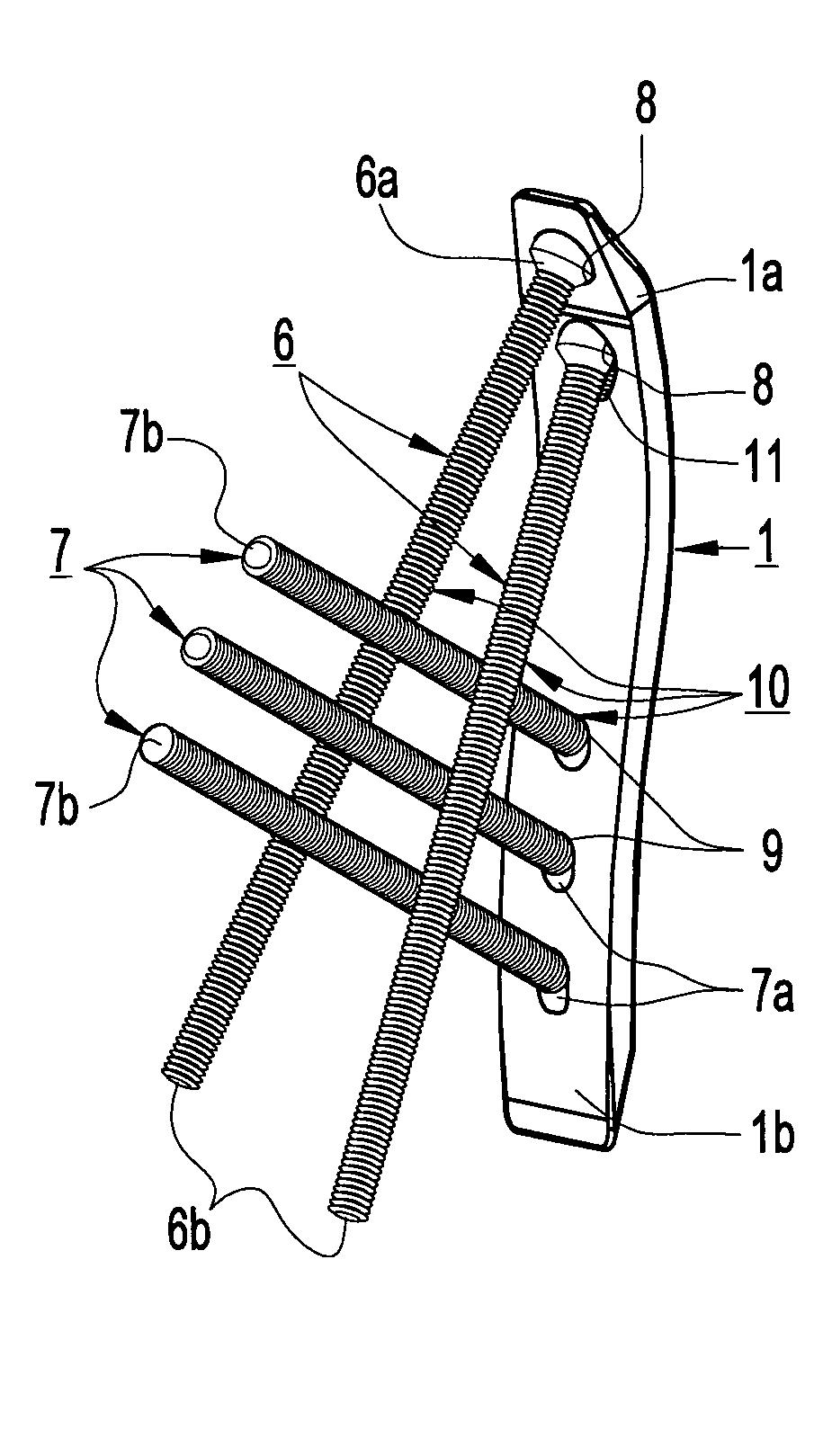 Device for internal fixation of the bone fragments in a radius fracture