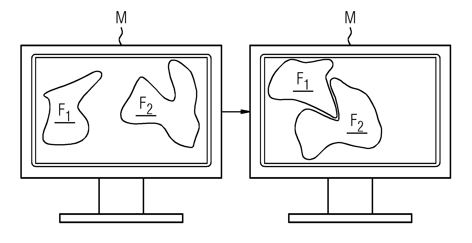 Bone Repositioning Based on an Automated Assignment