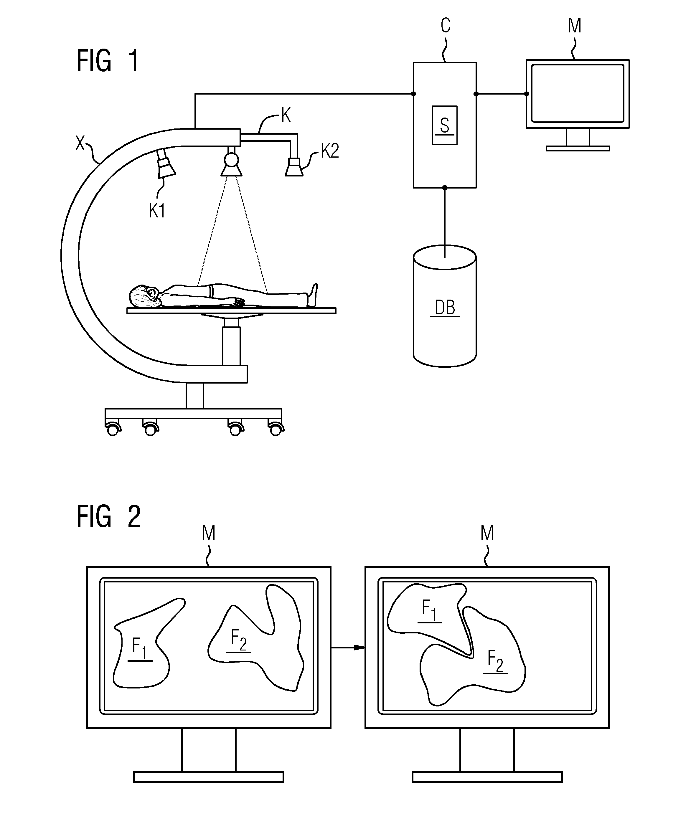 Bone Repositioning Based on an Automated Assignment