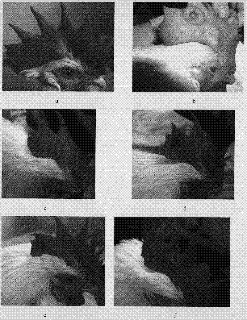 Medicinal composition for treating nevus flammeus and preparation method thereof