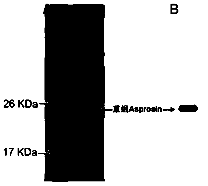 Application of asprosin in preparing medicine for treating ischemic heart disease