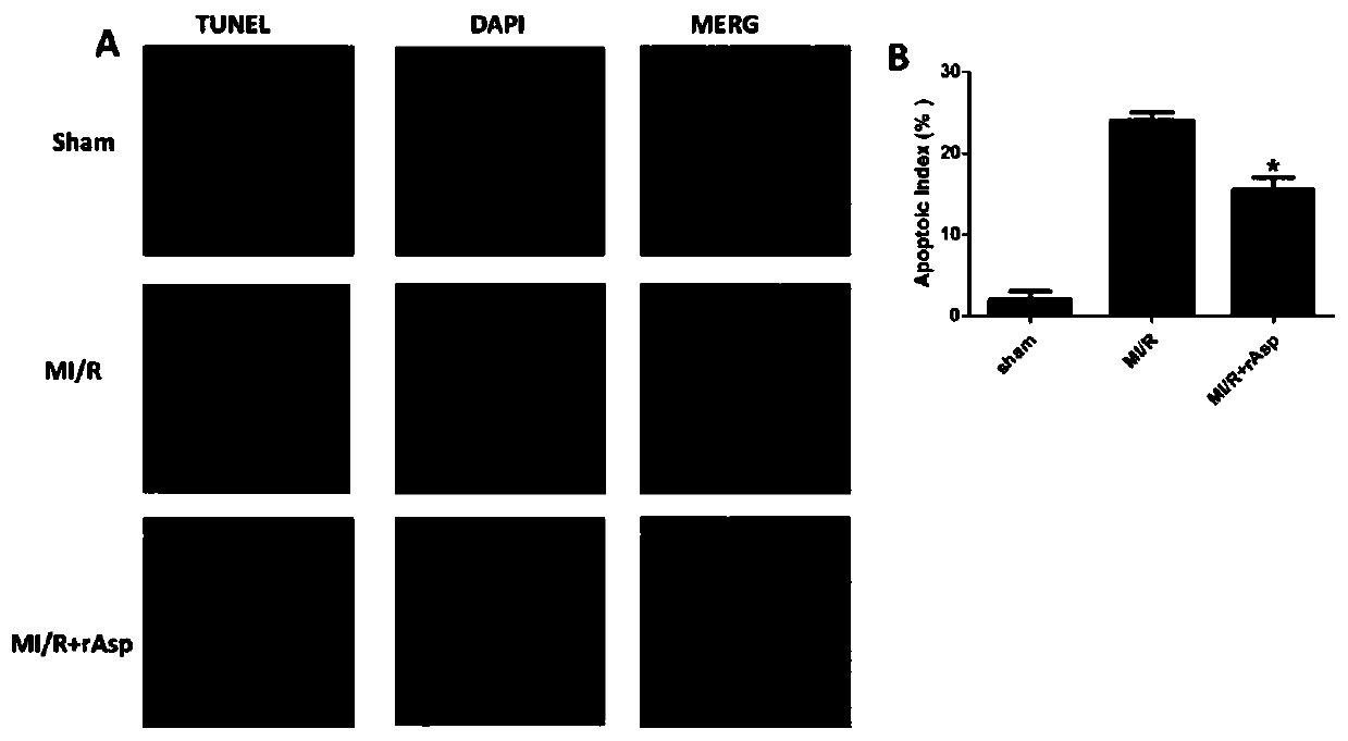 Application of asprosin in preparing medicine for treating ischemic heart disease