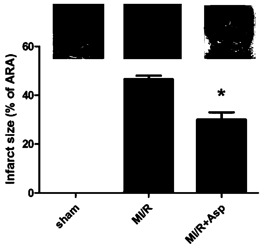 Application of asprosin in preparing medicine for treating ischemic heart disease