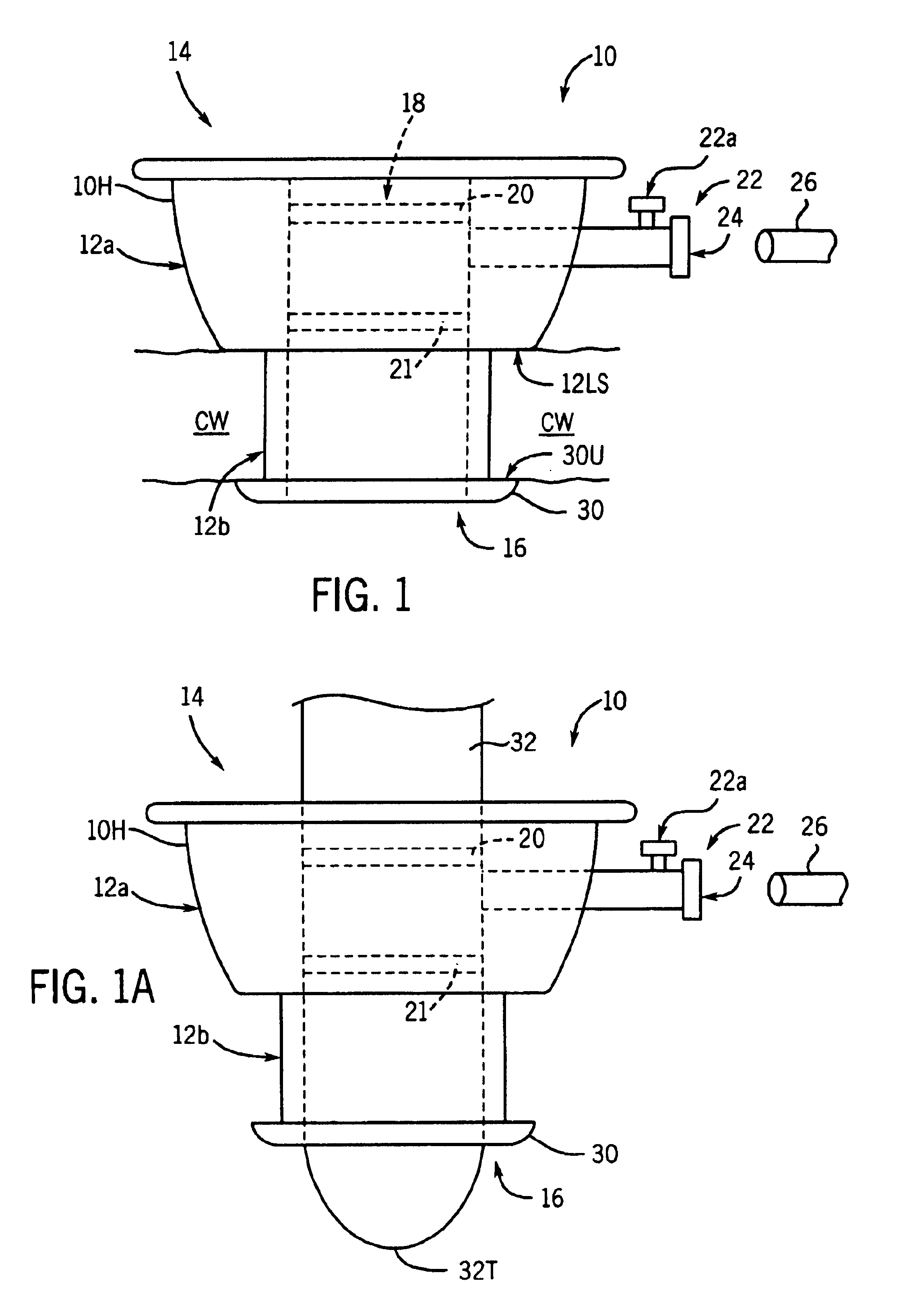 Apparatuses and methods for performing minimally invasive diagnostic and surgical procedures inside of a beating heart