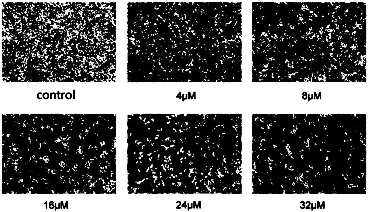 Application of quinoline derivatives of N-isostere tectorigenin in anti-hepatocarcinoma drugs