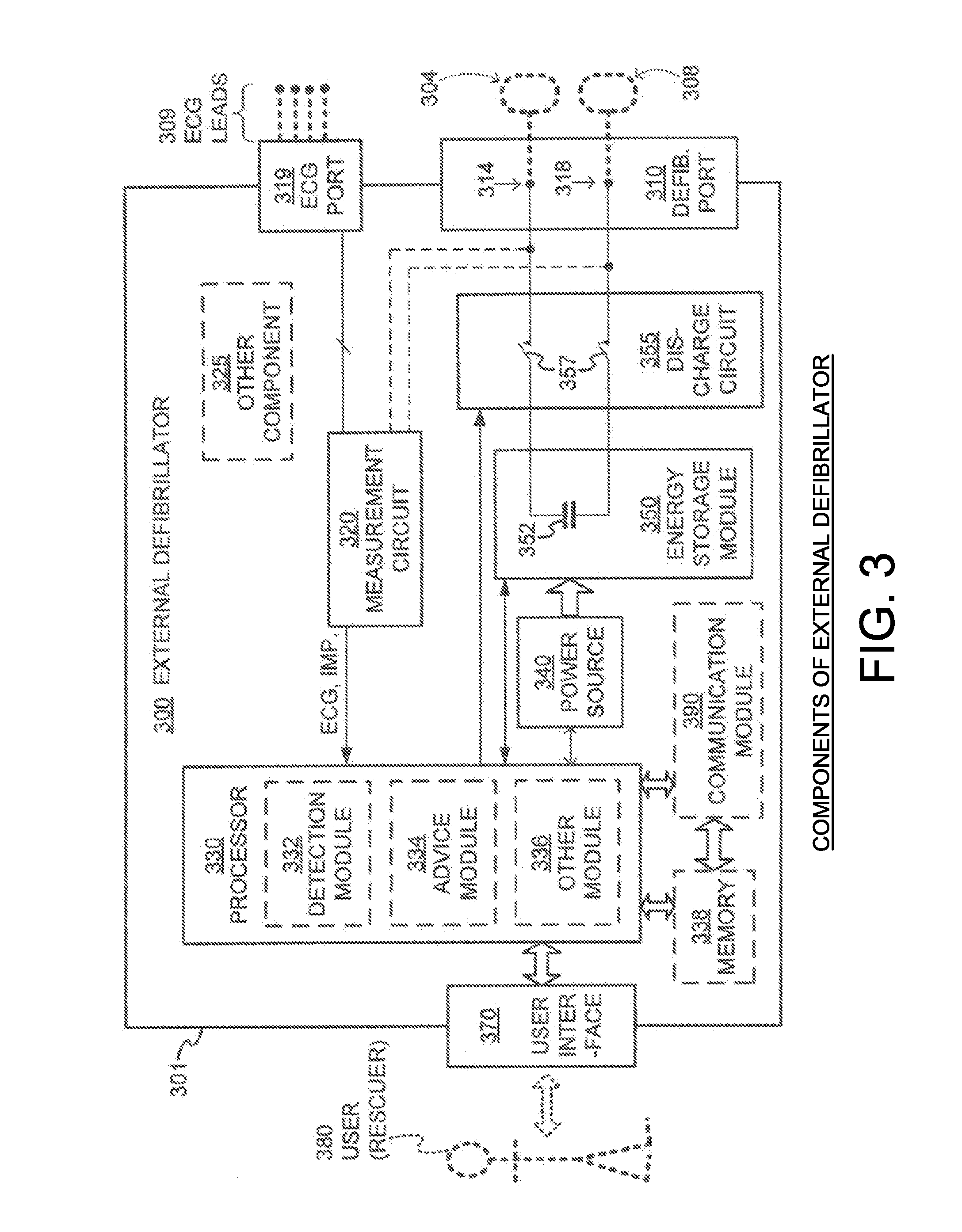 External Defibrillator Electrode, Method and System for Reducing ECG Artifact