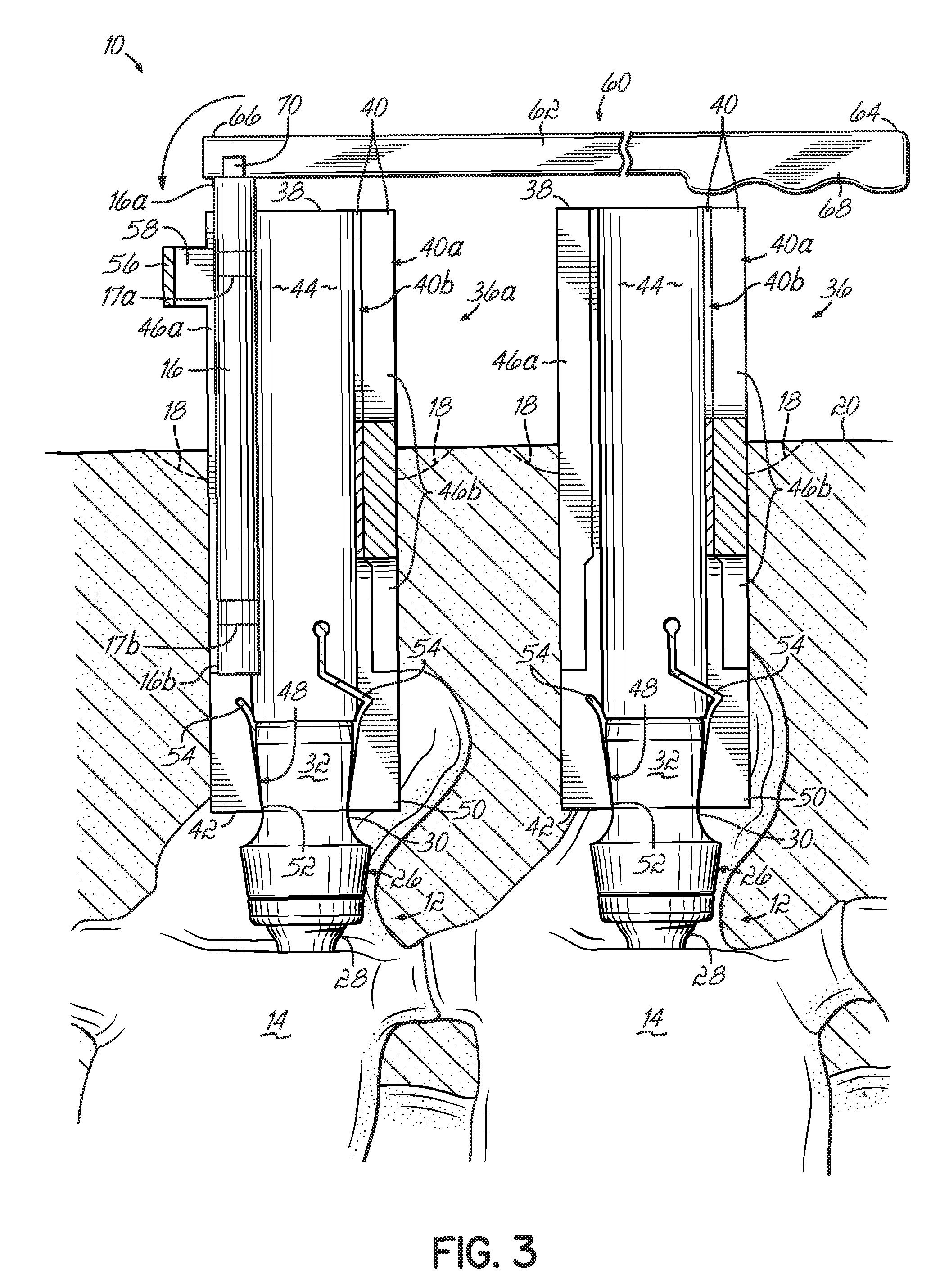 Instrumentation and associated techniques for minimally invasive vertebral rod installation