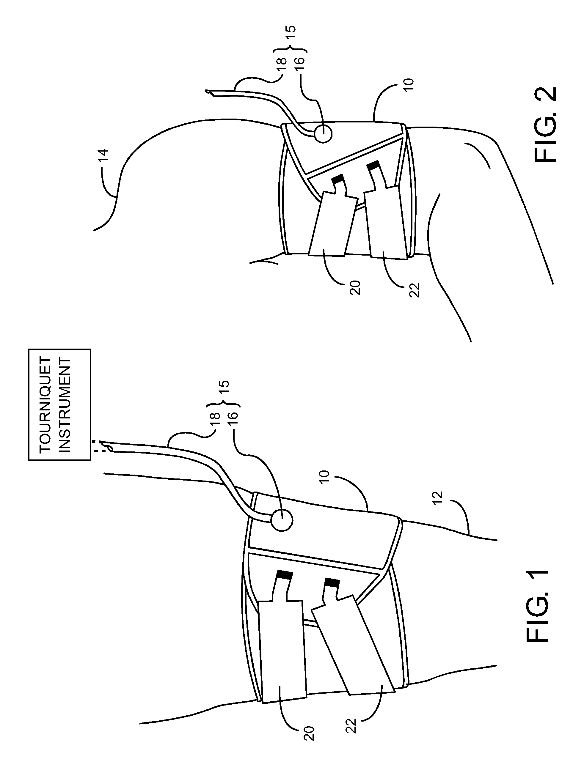 Low-cost contour cuff for surgical tourniquet systems