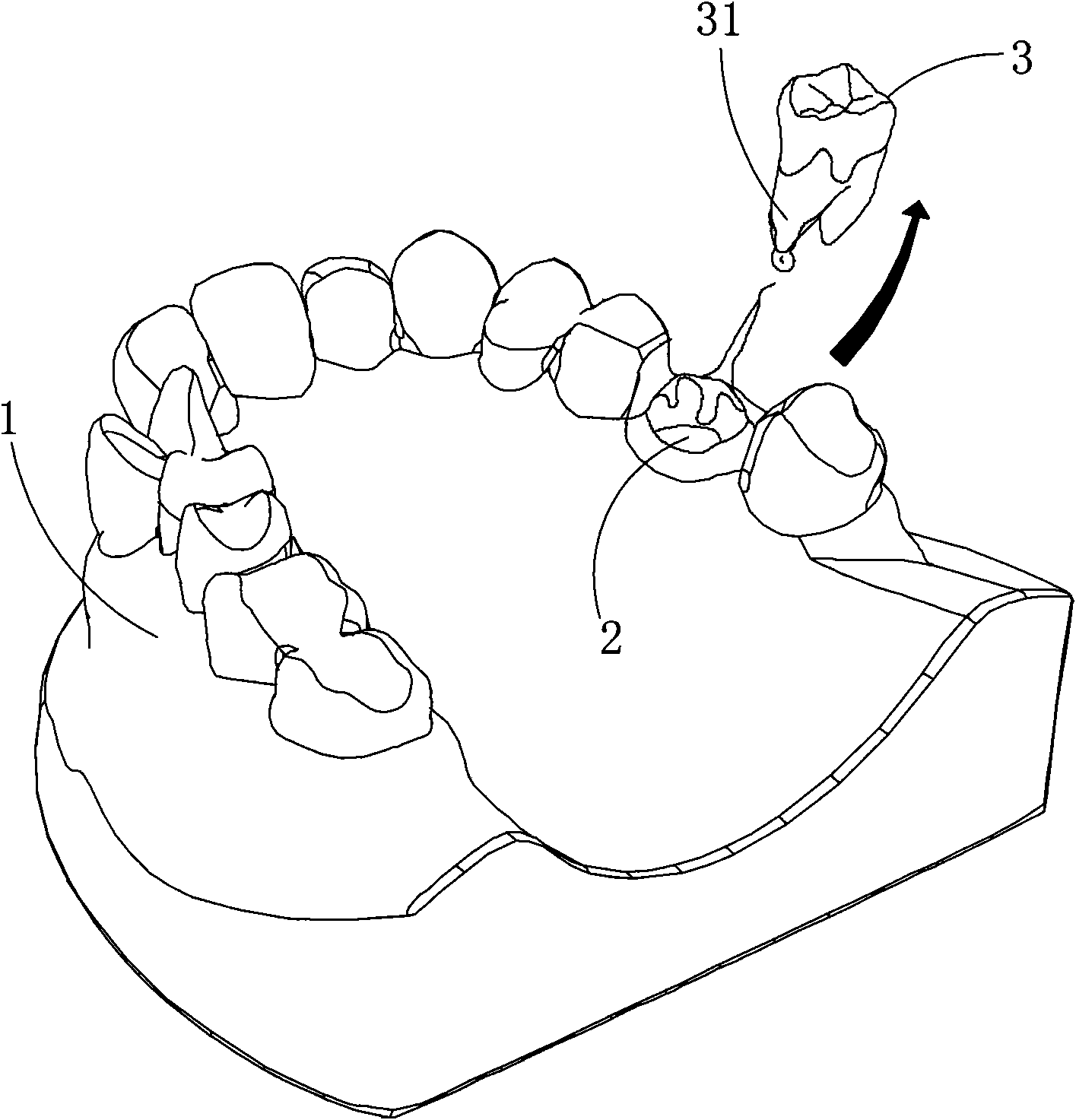 Tooth extracting model