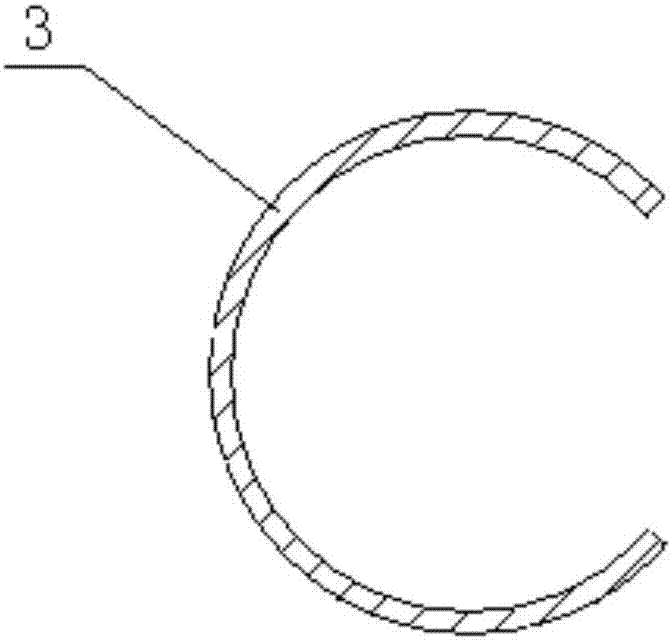 Radioactive particle stent used for radiotherapy in cavity tumor