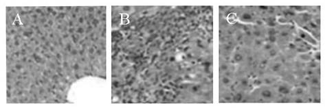 A stem cell preparation for treating liver fibrosis