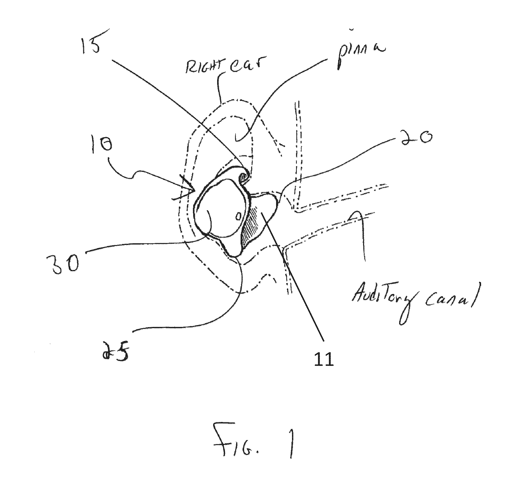 Sound System with Ear Device with Improved Fit and Sound