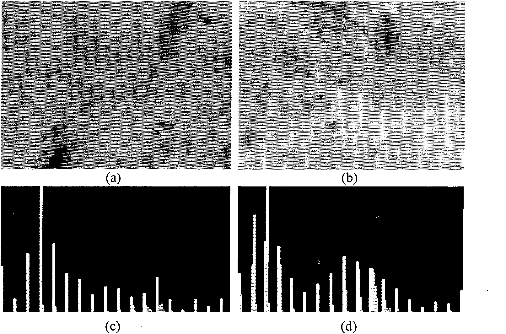 Tubercle bacillus target recognizing and counting algorithm based on diverse characteristics