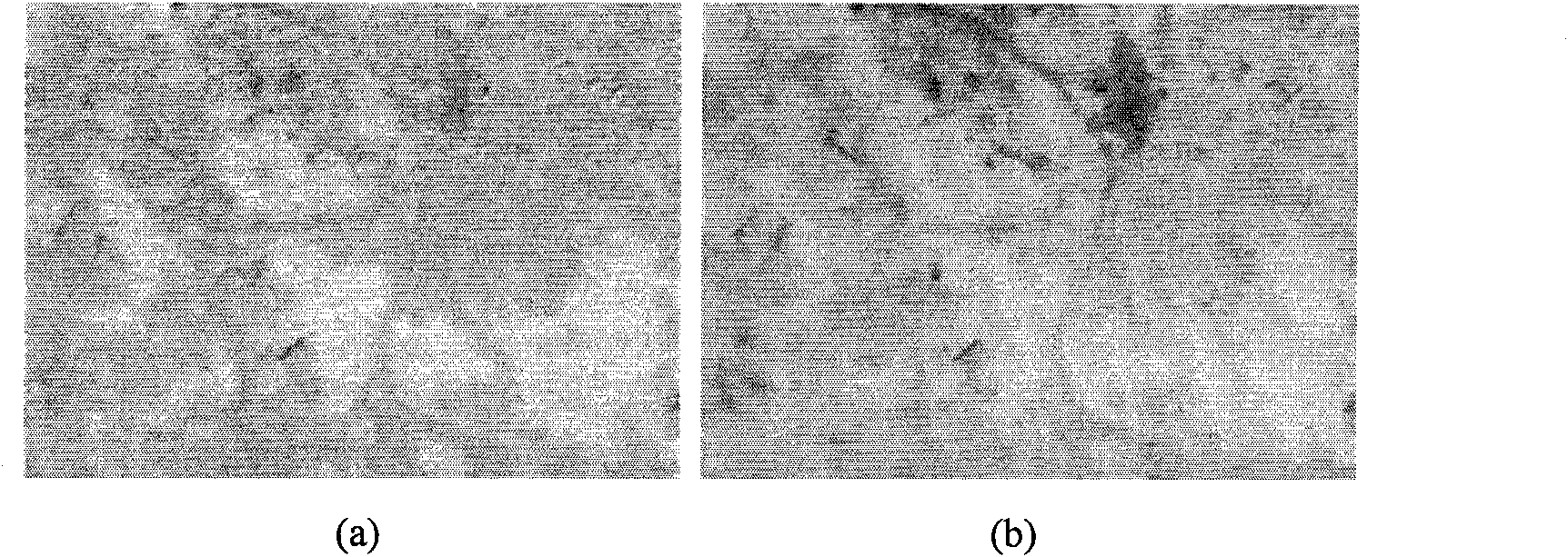 Tubercle bacillus target recognizing and counting algorithm based on diverse characteristics