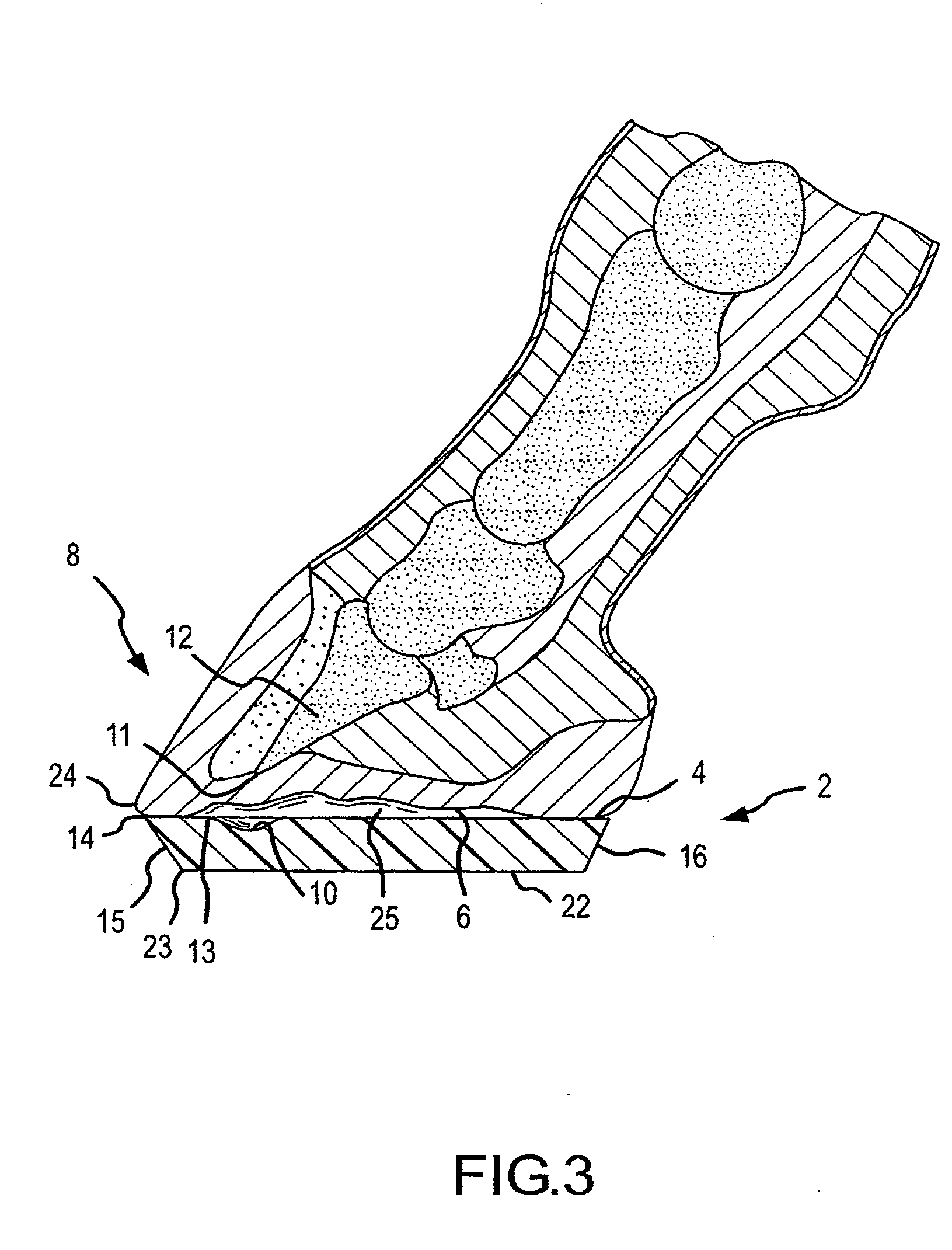 Equine hoof pad for break over modification