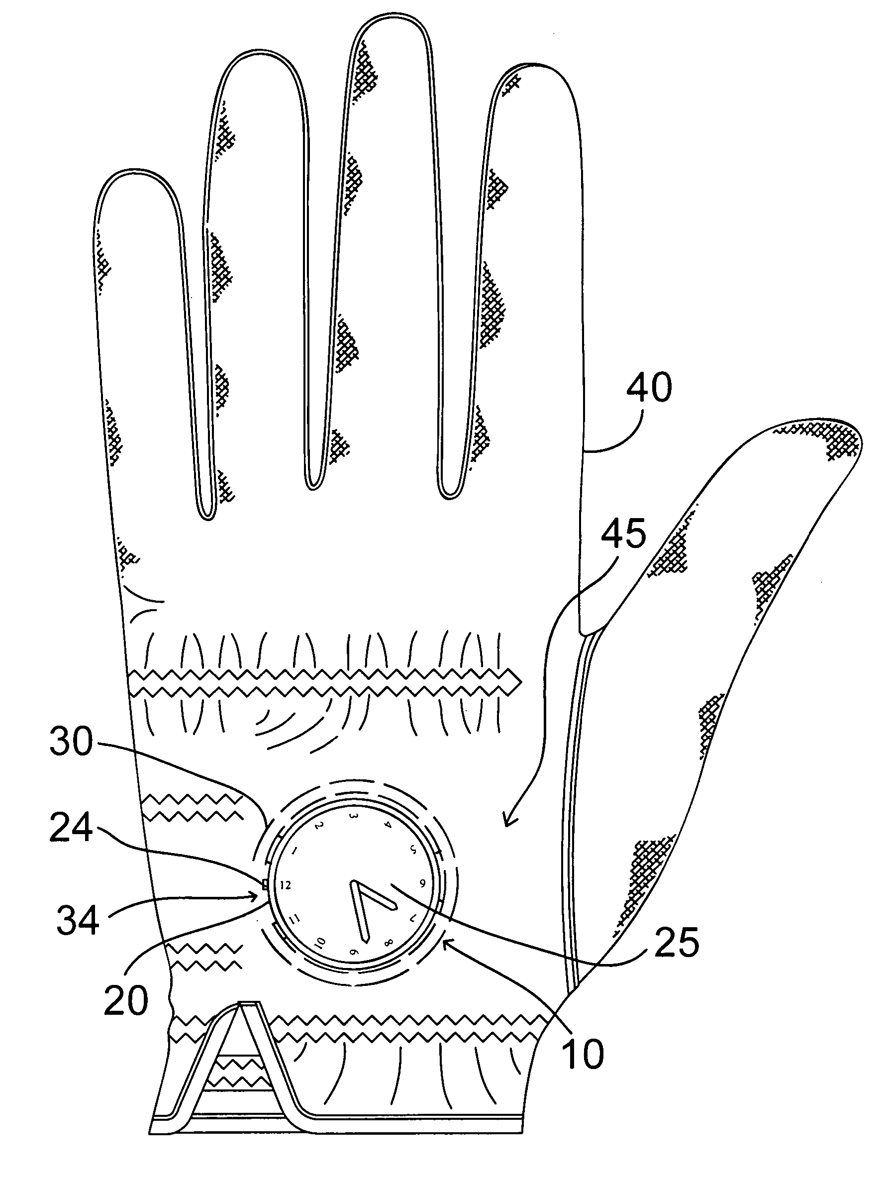 Watch head removably attachable to glove