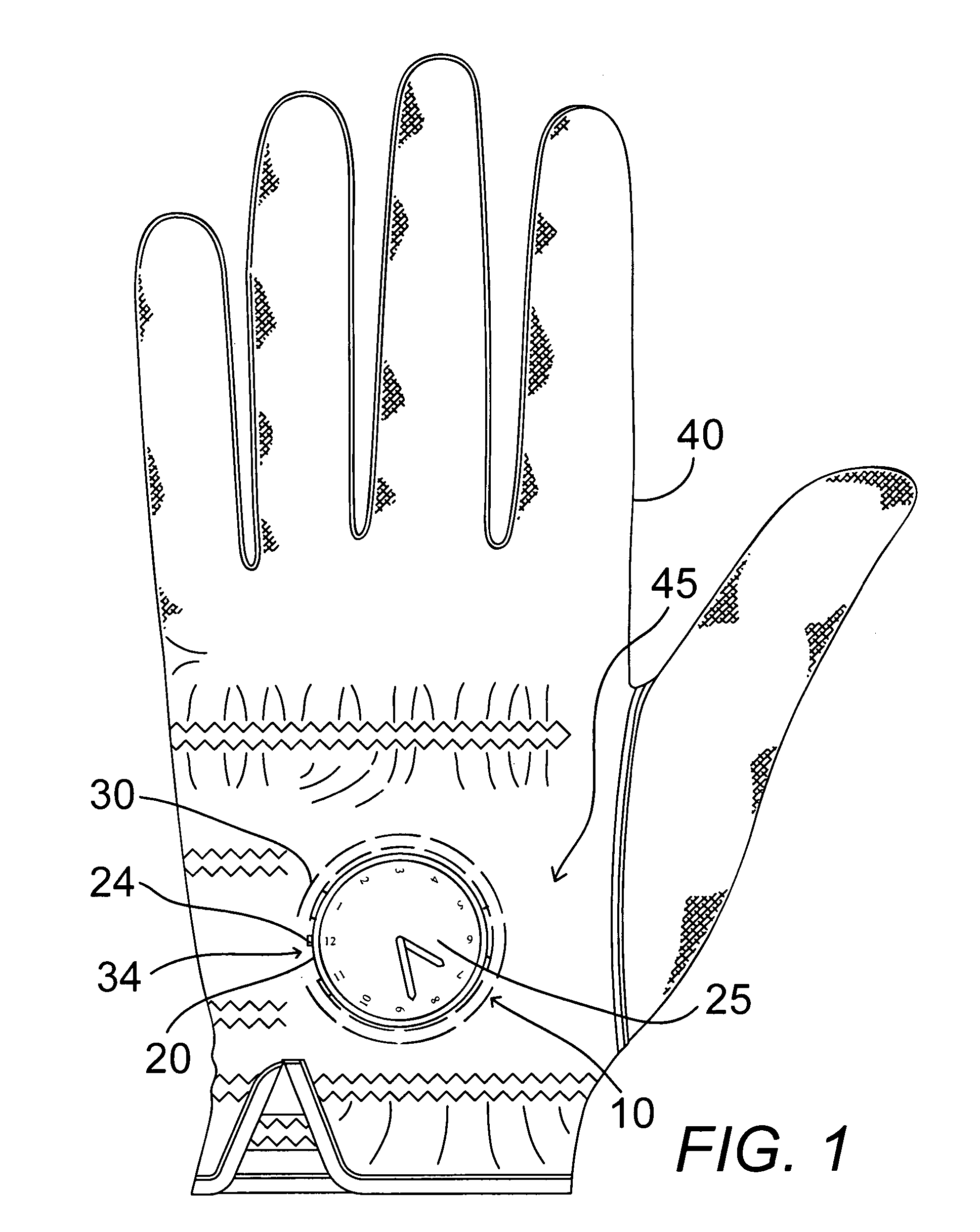 Watch head removably attachable to glove