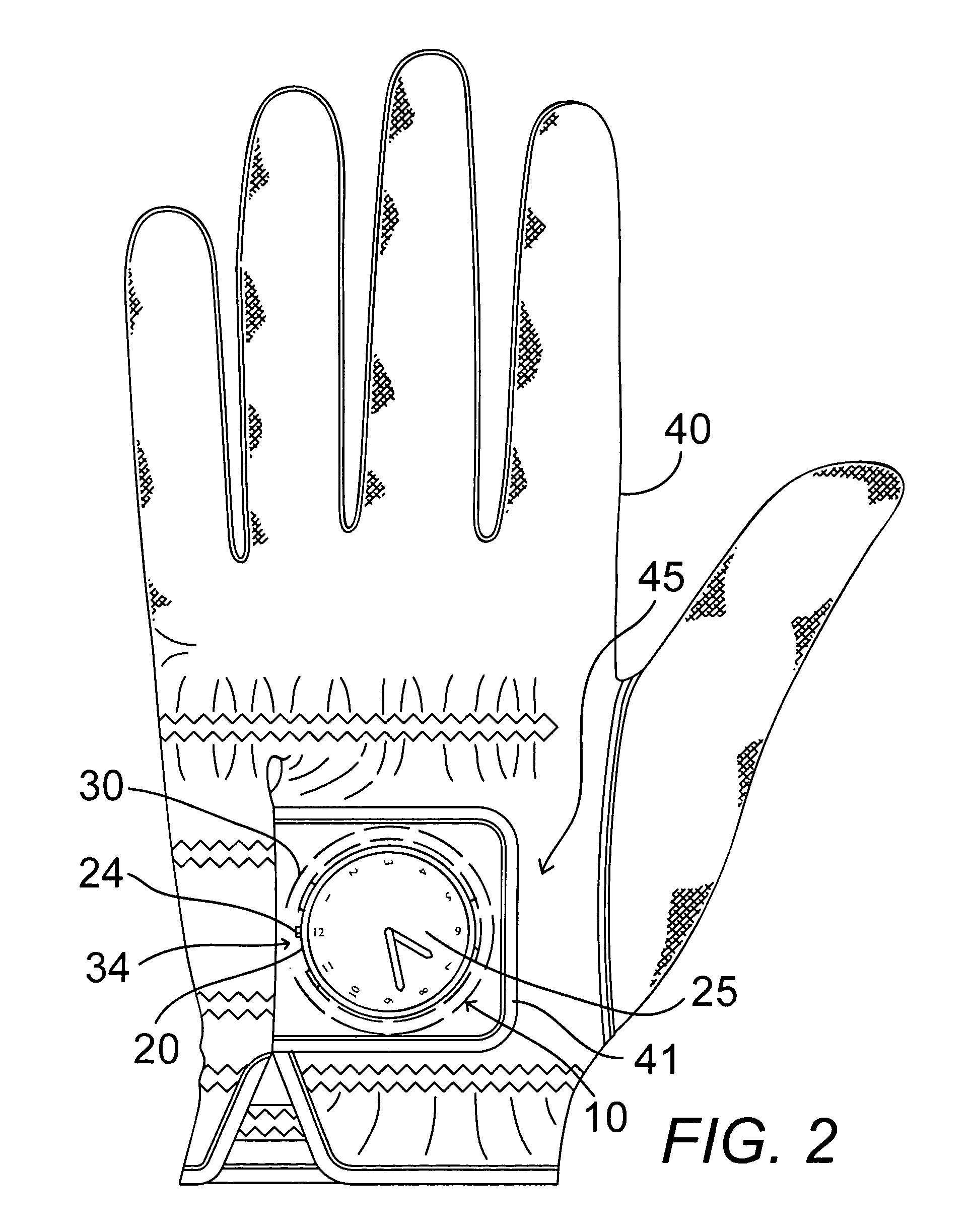 Watch head removably attachable to glove