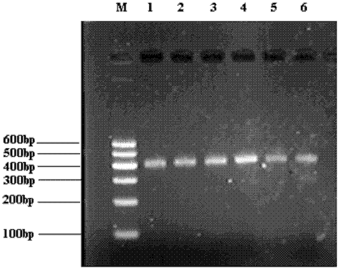 Human prolactin receptor antibody and application thereof