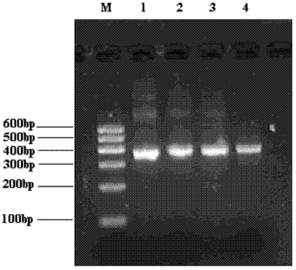 Human prolactin receptor antibody and application thereof