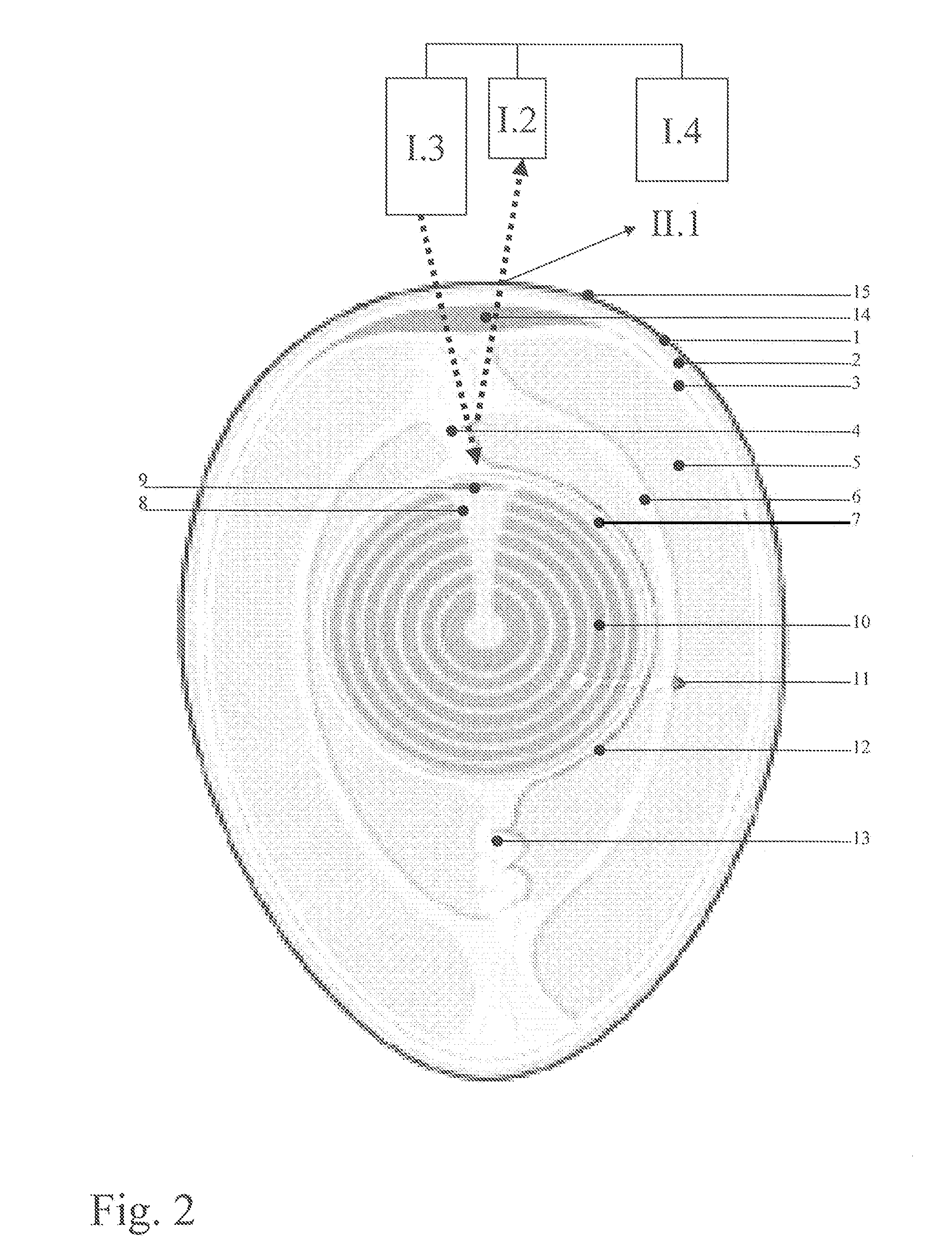 Method for avian sex determination