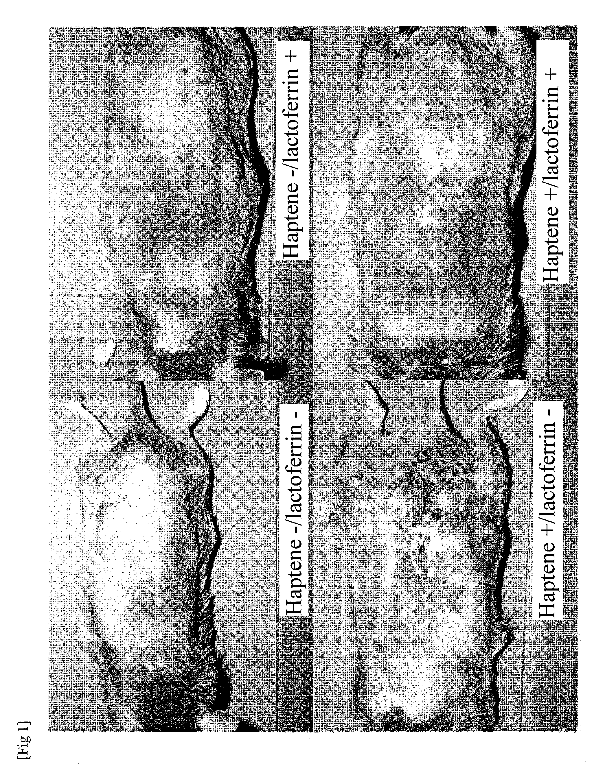 Atopic dermatitis marker and technique of using the same