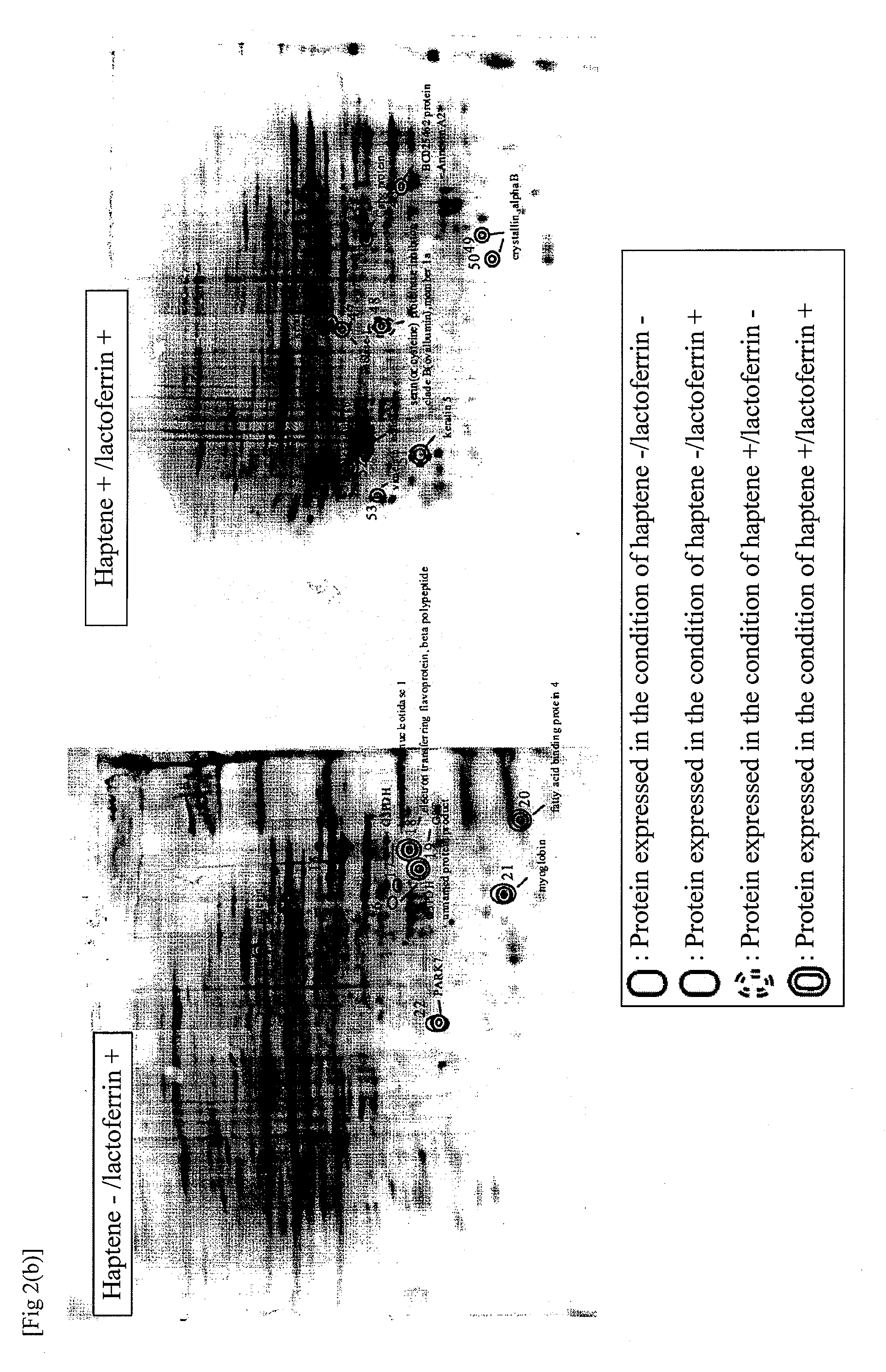 Atopic dermatitis marker and technique of using the same