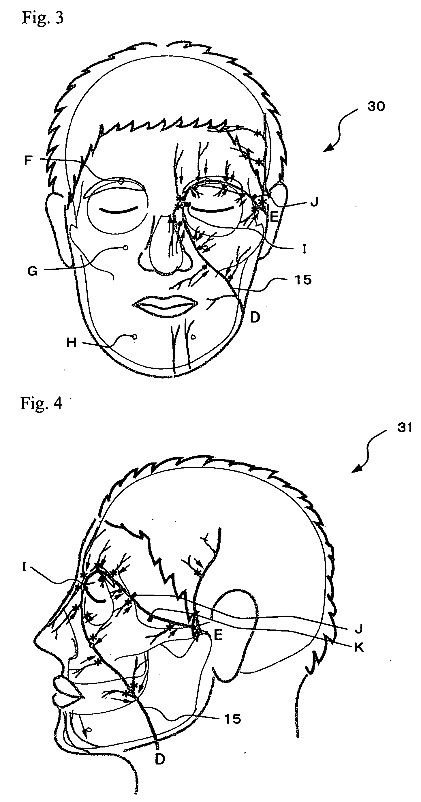 Indicator, method of teaching massage operation and method of massage operation