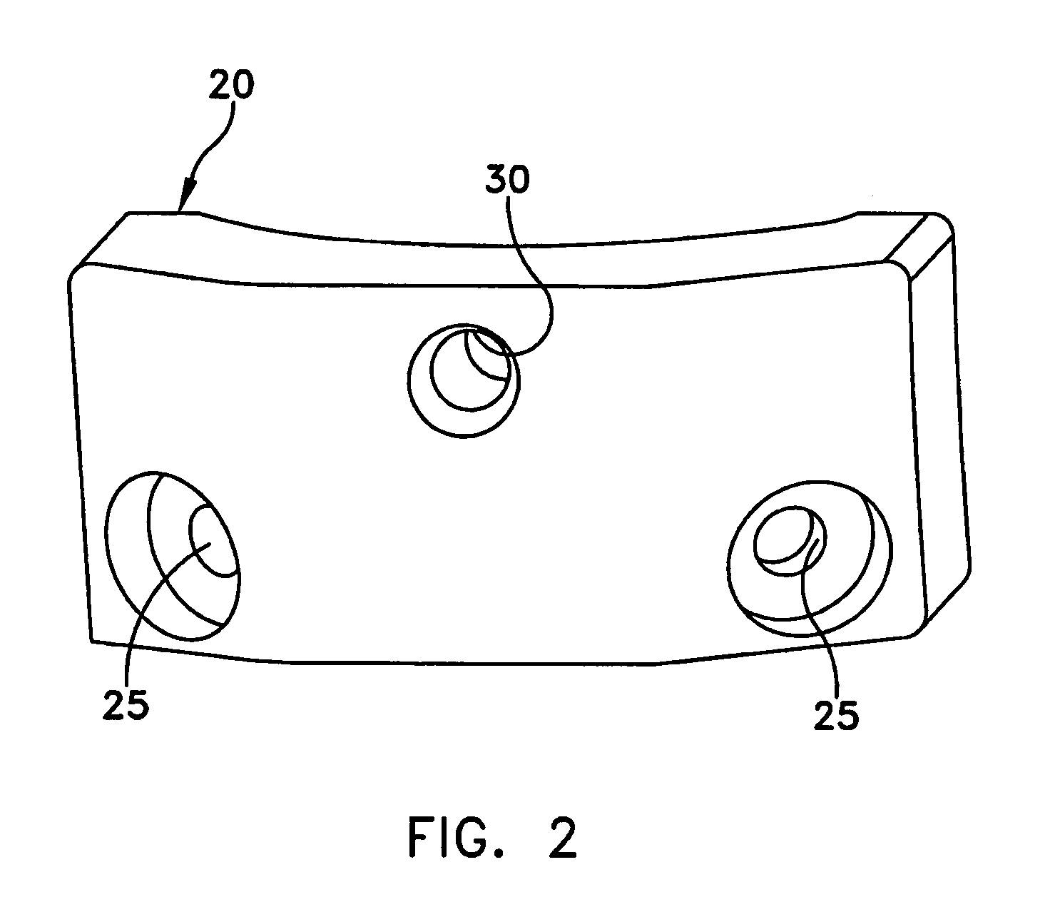 Open wedge osteotomy system and surgical method