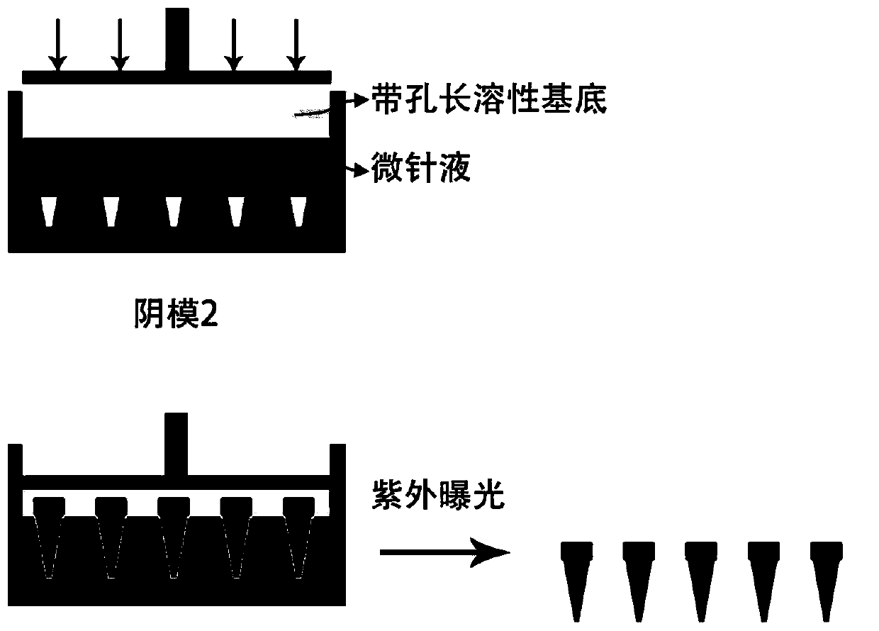 Microneedle patch for relieving skin acnes and preparation method thereof