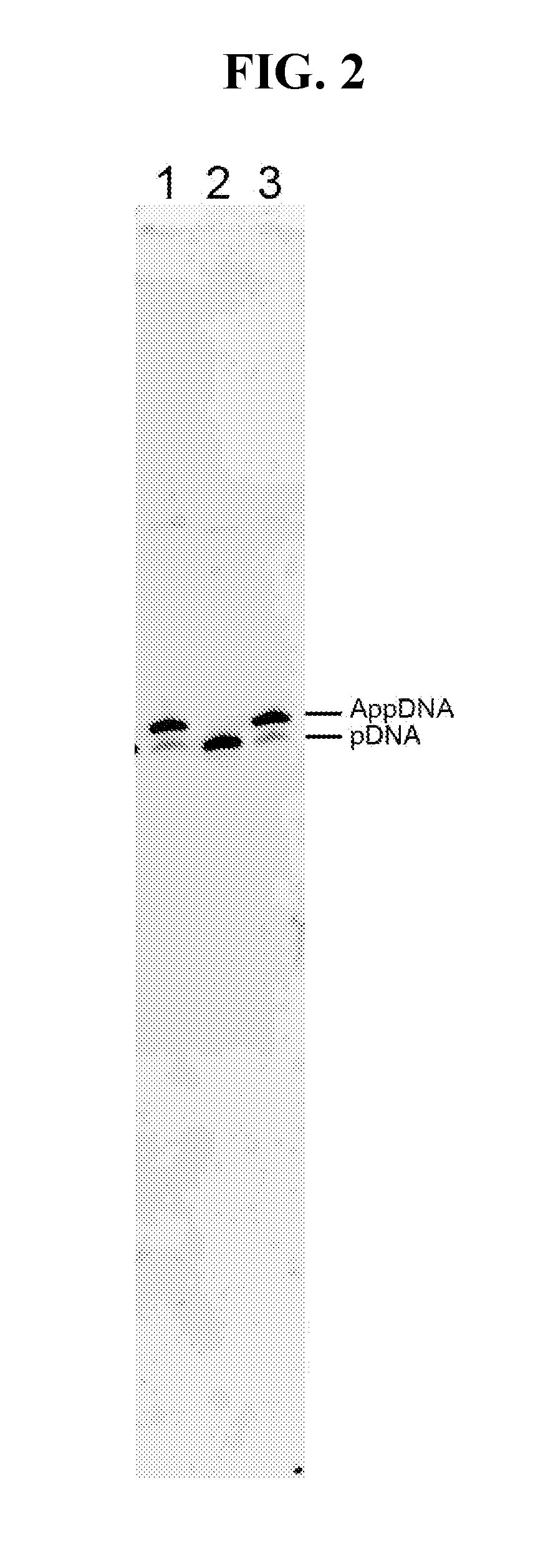 HYPER-THERMOSTABLE LYSINE-MUTANT ssDNA/RNA LIGASES