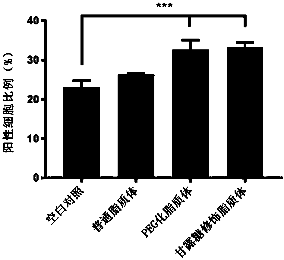 Immune targeting functional liposome as well as preparation method and application thereof