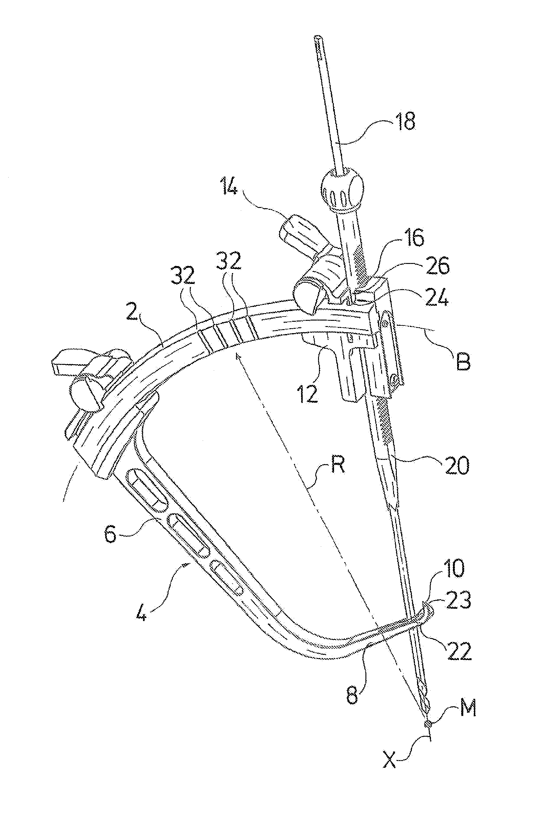 Surgical guiding device for reconstruction of anterior cruciate ligament