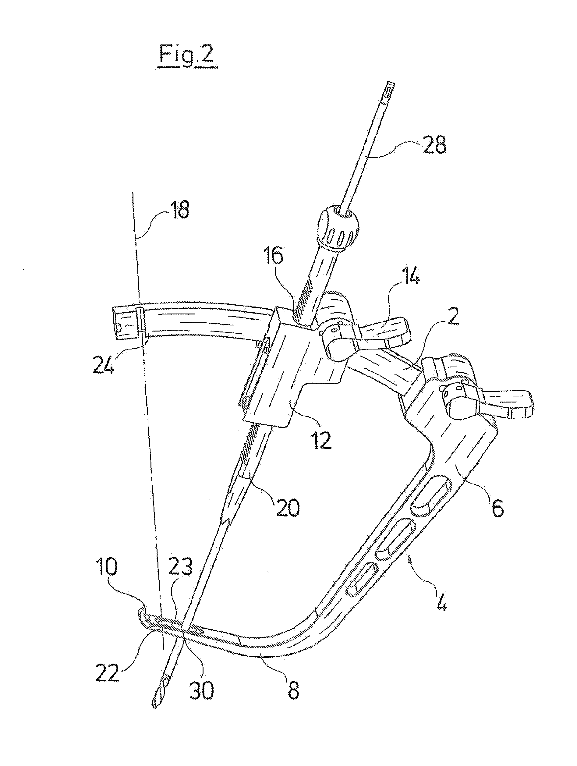 Surgical guiding device for reconstruction of anterior cruciate ligament