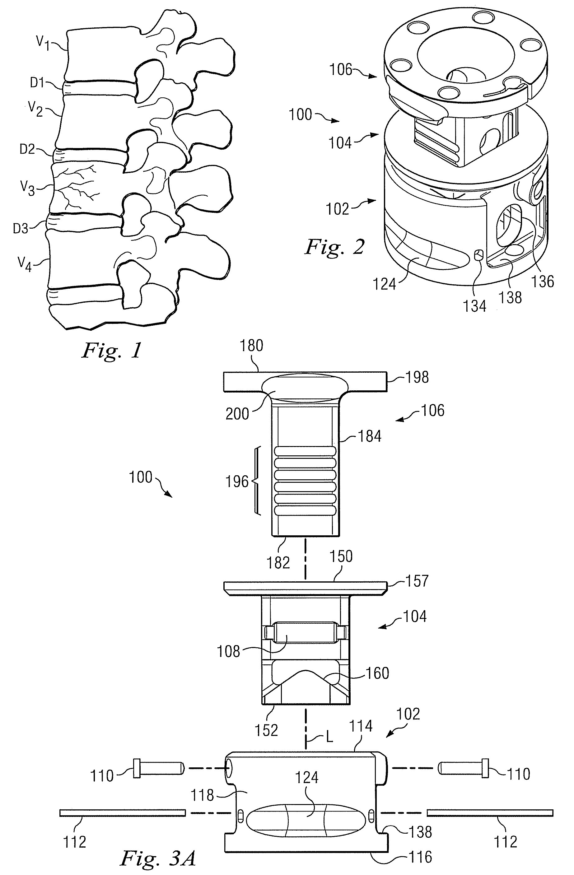 Expanding vertebral body implant