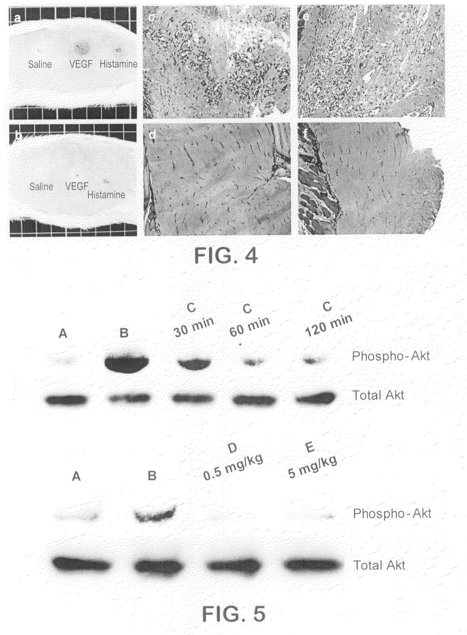 Kinase inhibitors and methods of use thereof