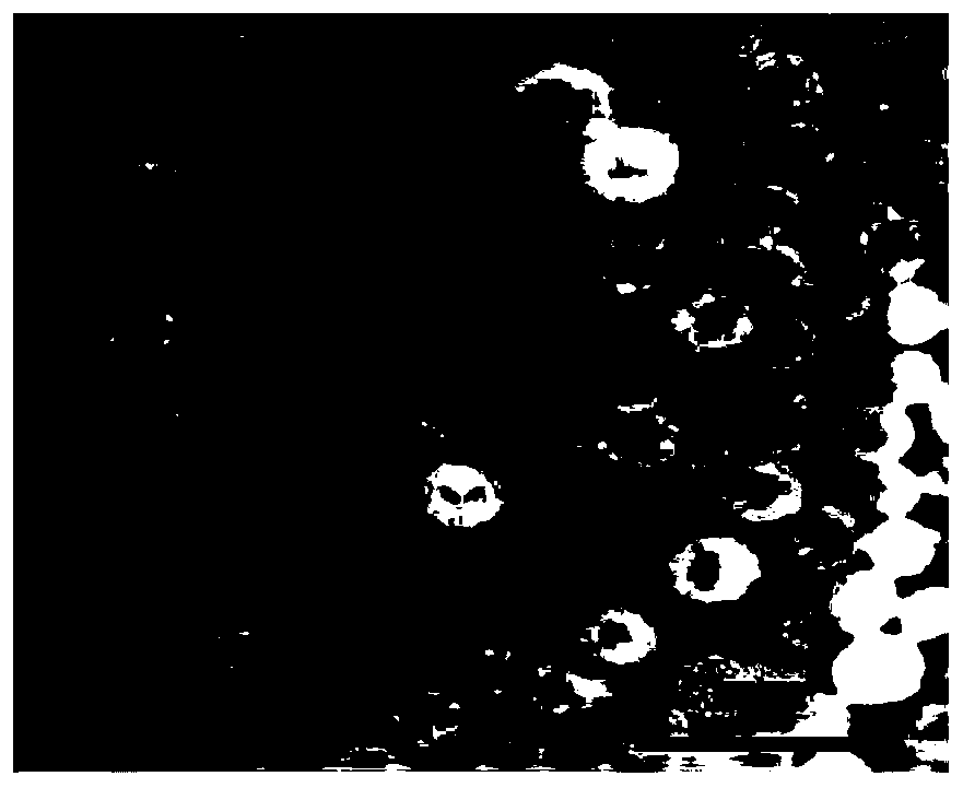 CT-visible mucous-adherence-type bifunctional microcapsules, and preparation method and application thereof