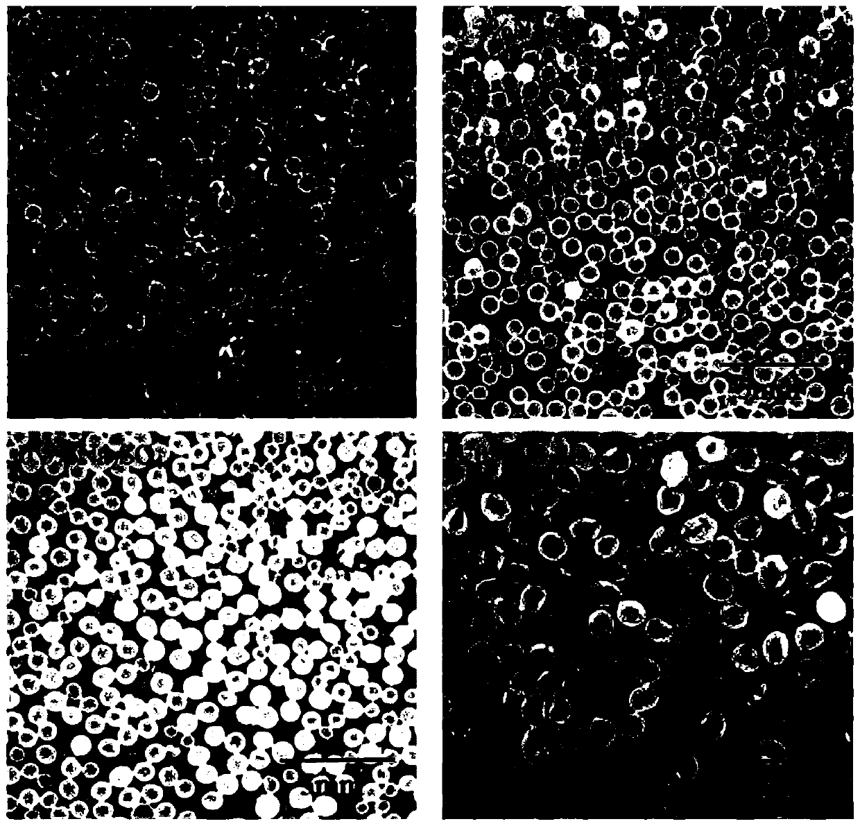 CT-visible mucous-adherence-type bifunctional microcapsules, and preparation method and application thereof