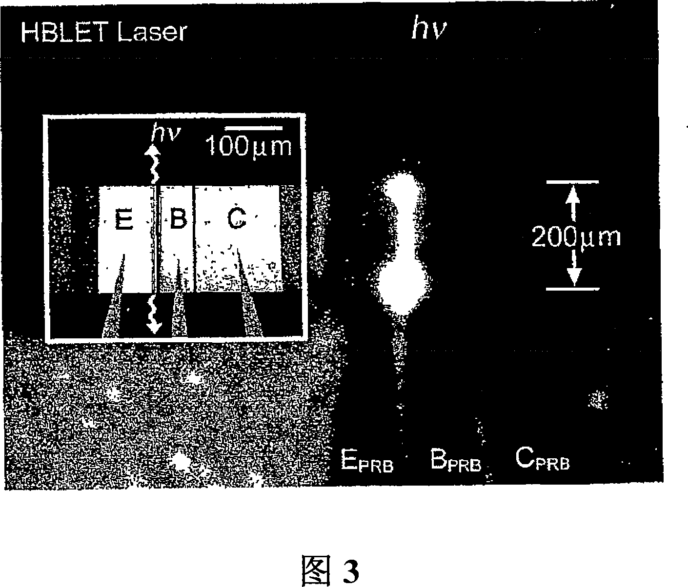 Semiconductor bipolar light emitting and laser devices and methods