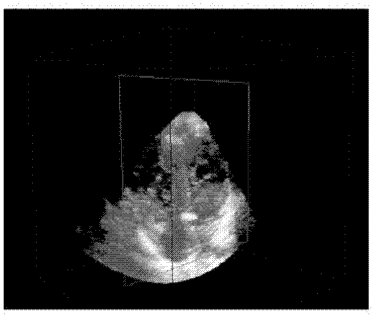 Quantitative analysis method for three-dimensional geometric structure of heart mitral valve device